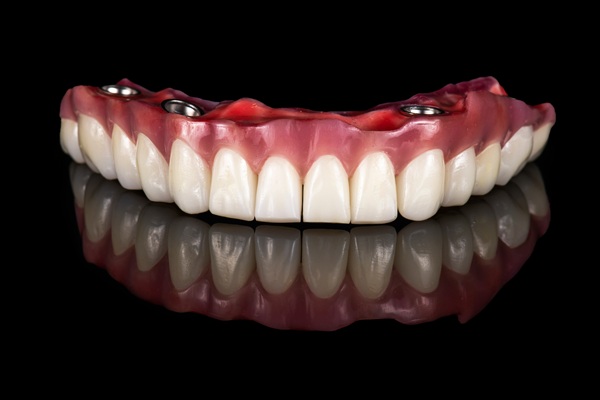 Replacing Upper Or Lower Set Of Teeth With All On