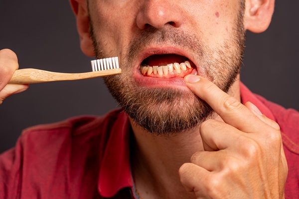Warning Signs You May Need Periodontics